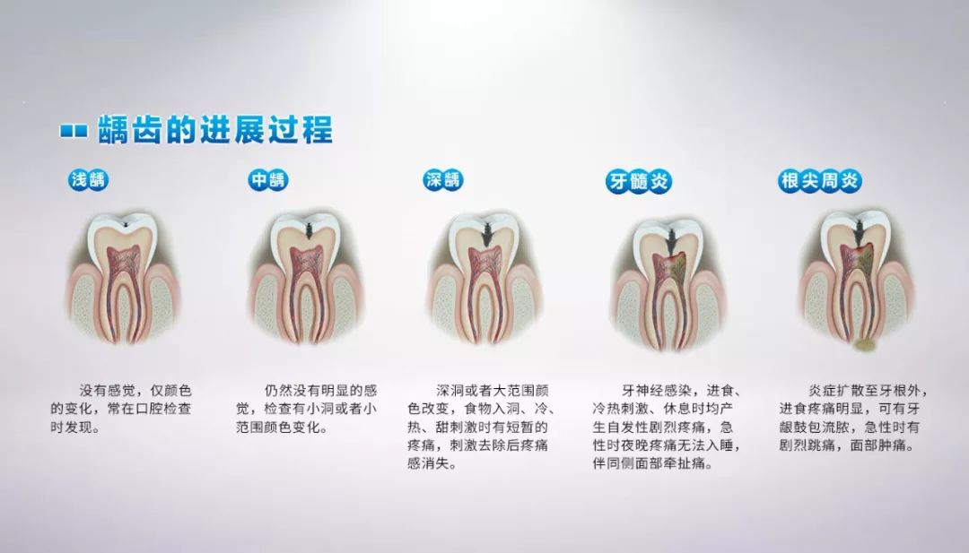 真正有效防止儿童龋齿的方法你知道吗?不知道还不来看看?