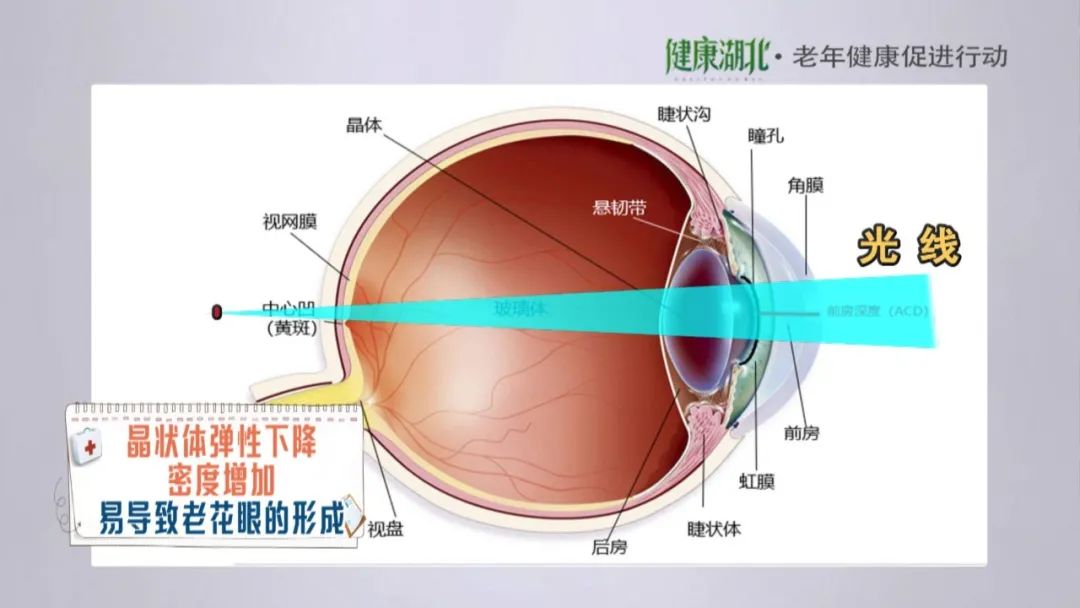 而眼睛的视觉成像原理就是物体的反射光通过晶状体折射成像于视网膜上