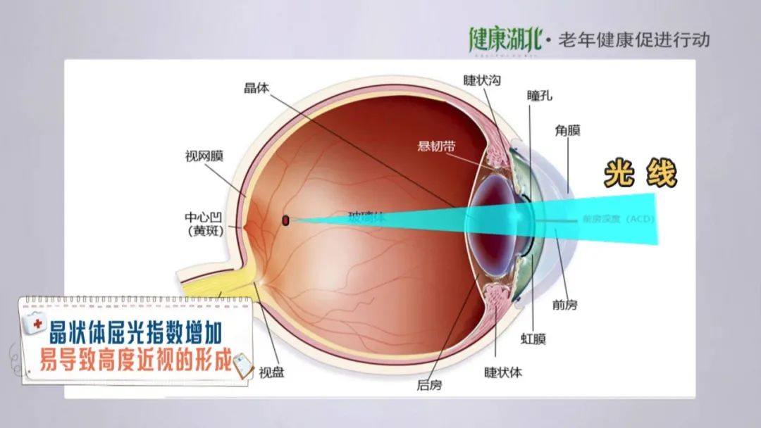 眼睛真的能返老还童吗