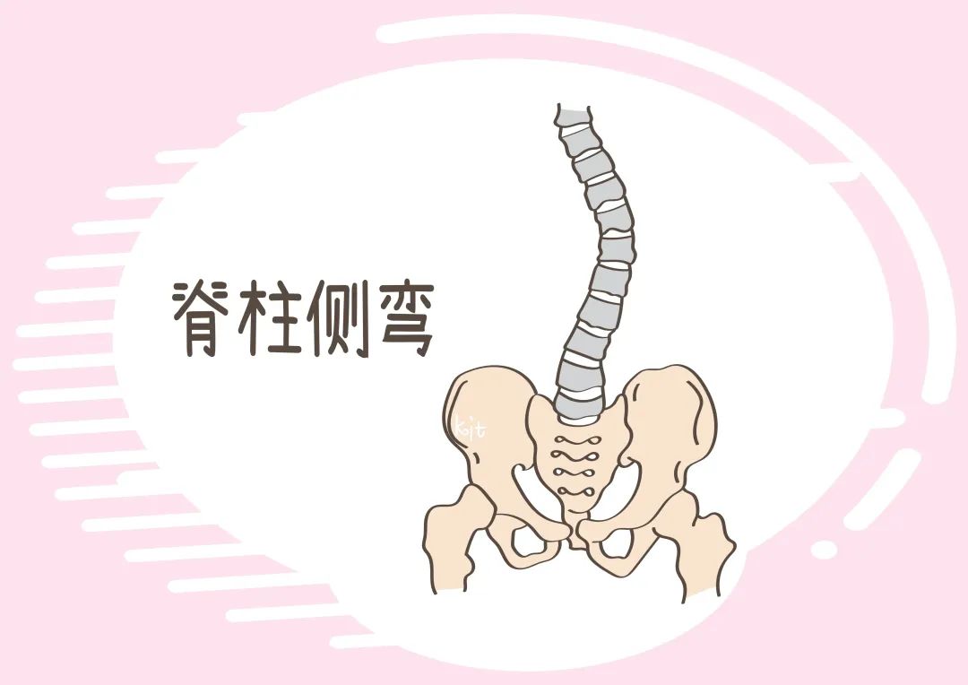 老太太脊柱严重畸形只能坐着做饭手术助其重新挺直腰杆