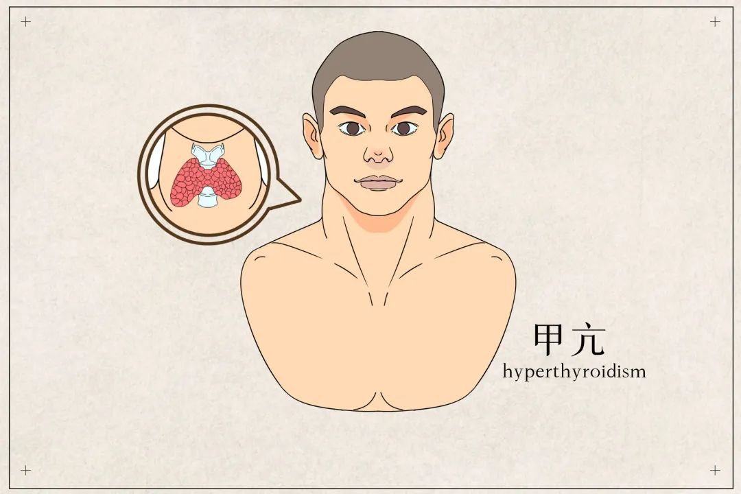 居家期间这4点关于甲状腺的知识了解一下