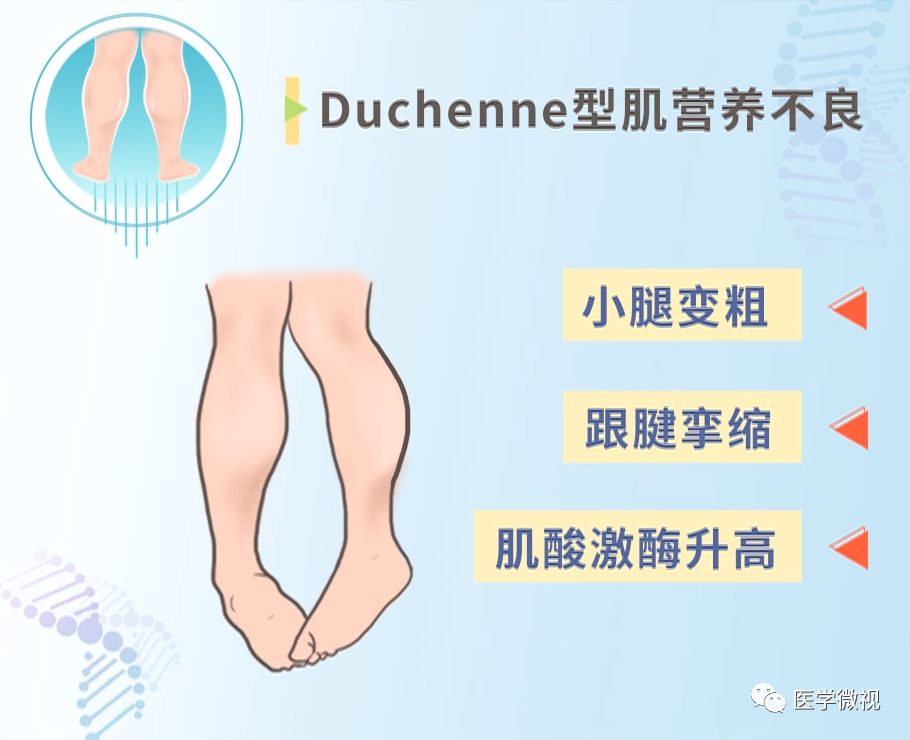 罕见病援助：一道温暖的光