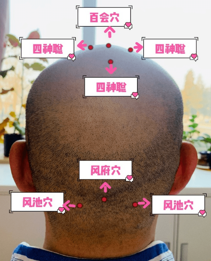 头部刮痧妙处多多学起来吧