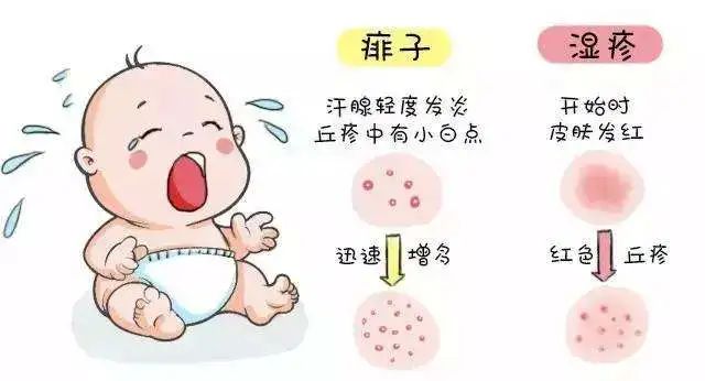 什么叫湿疹 湖北网络广播电视台