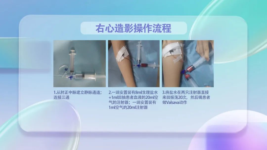 关于超声检查的那些事你想知道的都在这里