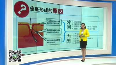 －－生活小贴士：夏季痤疮如何护理