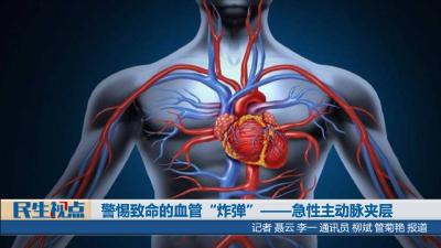 【民生视点】警惕致命的血管“炸弹”——急性主动脉夹层