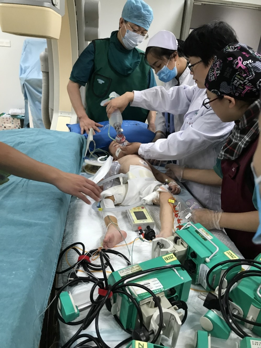 武汉同济医院多科室齐上阵 为3岁小患儿植入永久心脏起搏器_长江云