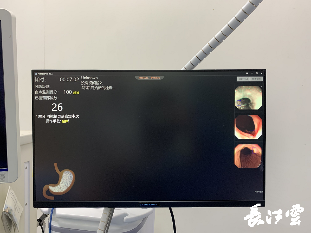 世界最强内镜精灵检测消化道早期癌准确率高达92