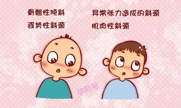 宝宝出生就会歪头卖萌,当心小儿斜颈作怪