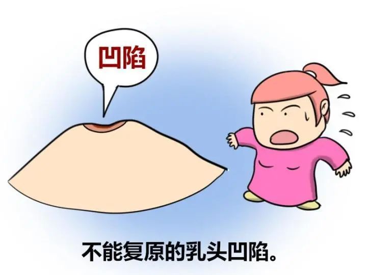 乳房皮肤桔子皮样图片图片