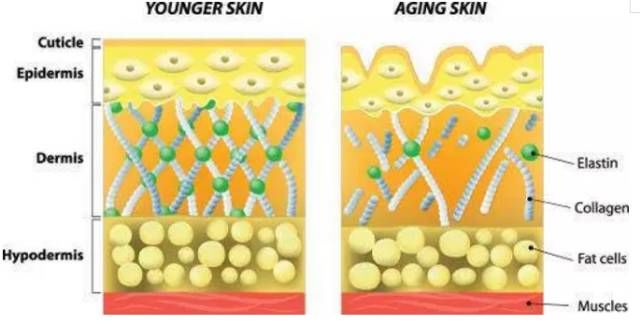 胶原蛋白含量减少69皮肤真皮网状层出现这些变化的主要原因就是在