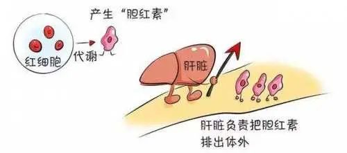 太黄了怎么办新生宝宝要美白吗