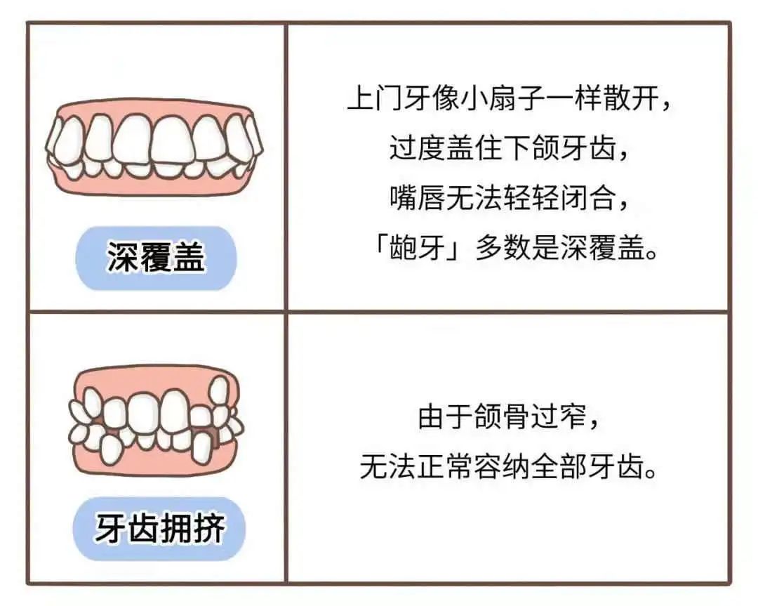 常见的牙齿错颌畸形有以下 6 类,当牙齿出现类似情况,一定要及时去