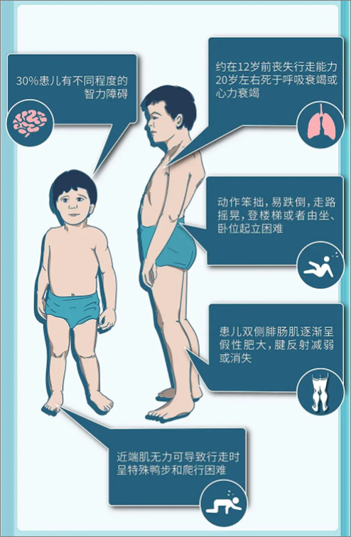 dmd世界关爱日 | 传男不传女的,除了祖传秘籍,也有可能是这种疾病!