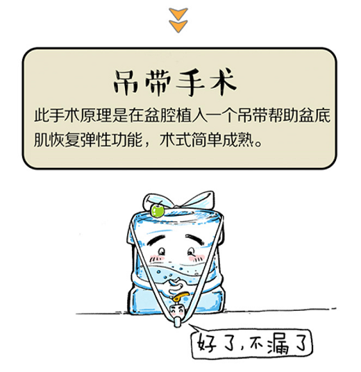 一文读懂尿失禁