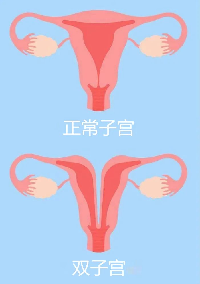 多年未孕但吴女士患有罕见的双子宫是很多适龄女性的心愿当妈妈