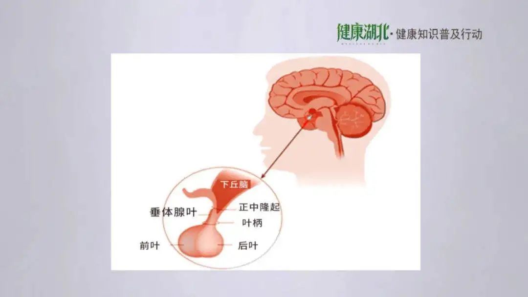 別讓垂體瘤在腦中興風作浪