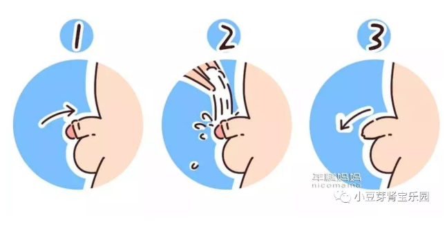 男孩子患有包皮,包茎等问题的男生,特别要对包皮处进行彻底清洁,以免