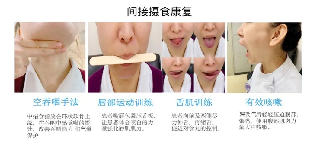 约三分之一的老人有吞咽障碍,想吃一口饭这么难吗