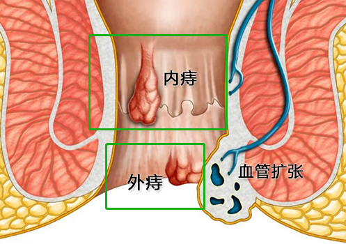今天你提了吗看完菊花突然一紧