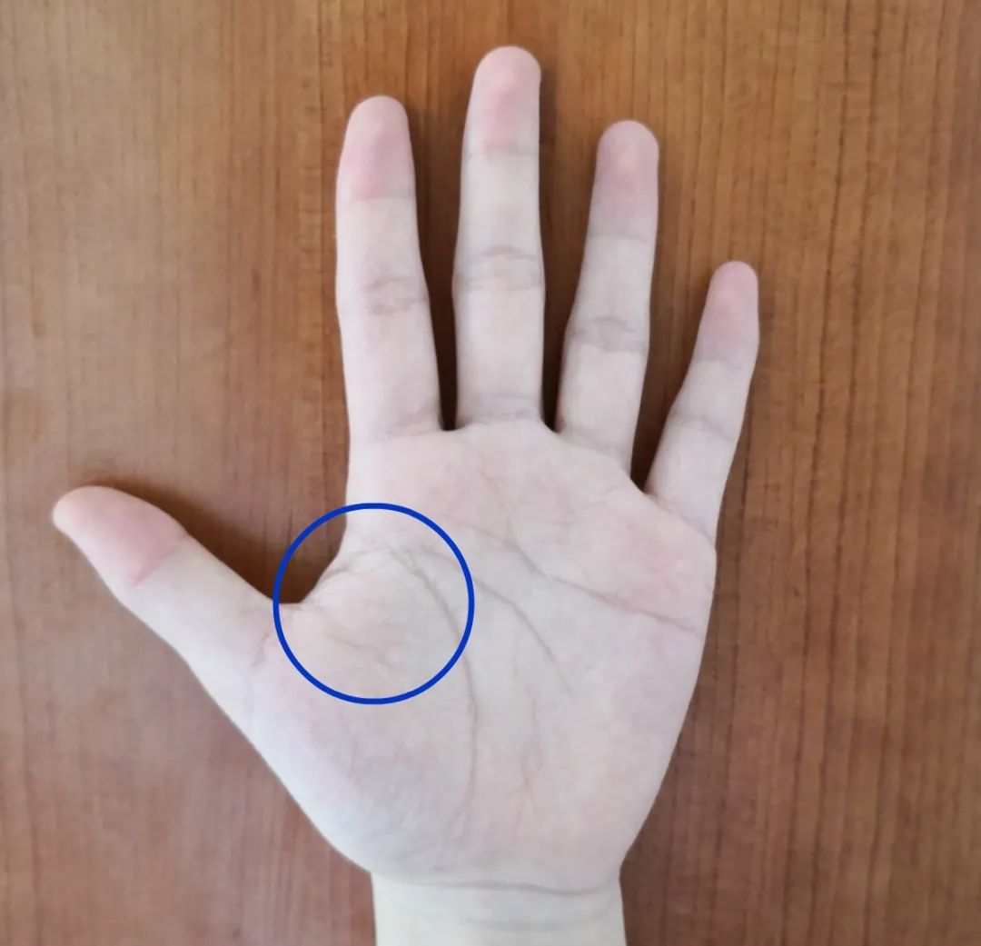 手掌青筋不退竟然是血管在报警抓紧时间去医院查一查可能发现大问题