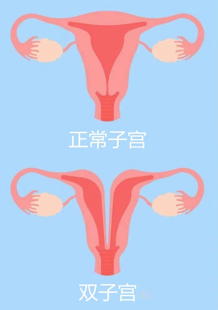 双子宫b超图片图片