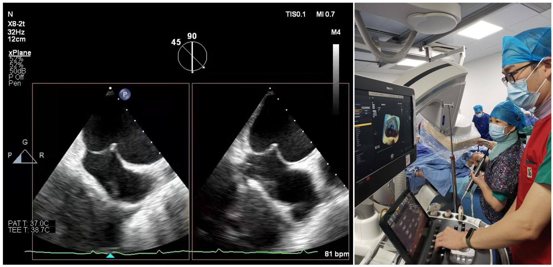 标志着湖北结构性心脏病诊治领域再次实现重大突破,处于全国领先水平