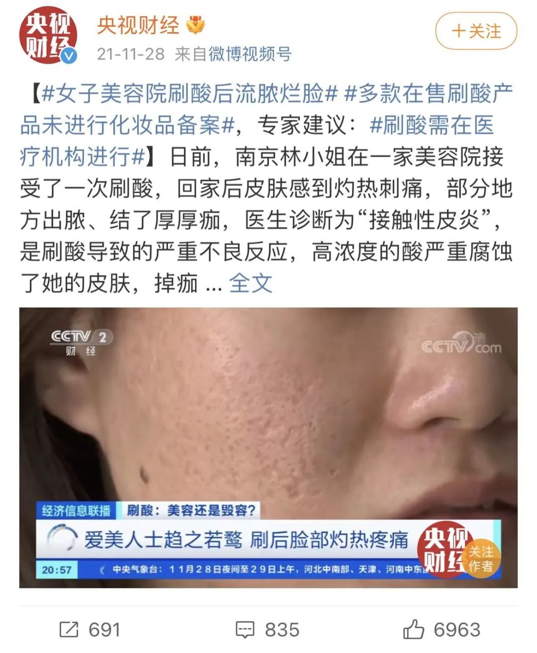 刷酸美容还是毁容关键看这个