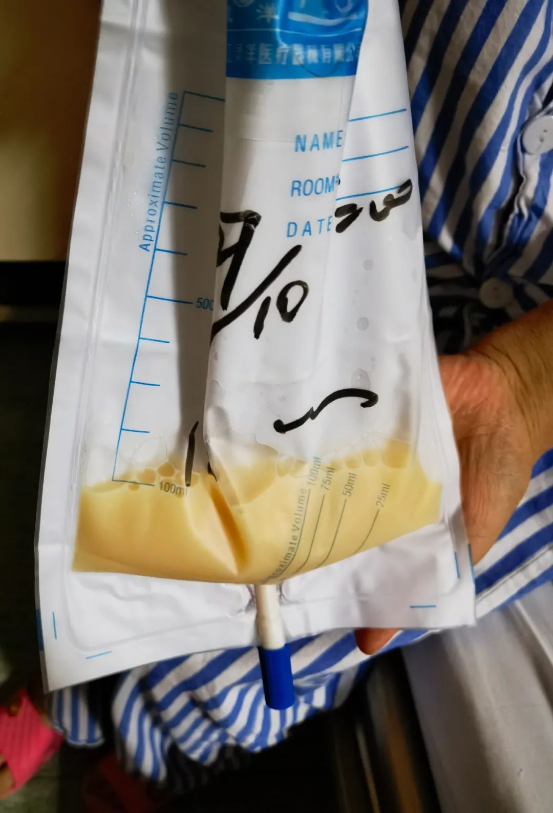 27岁象山小伙每天产奶2斤竟是这里漏了