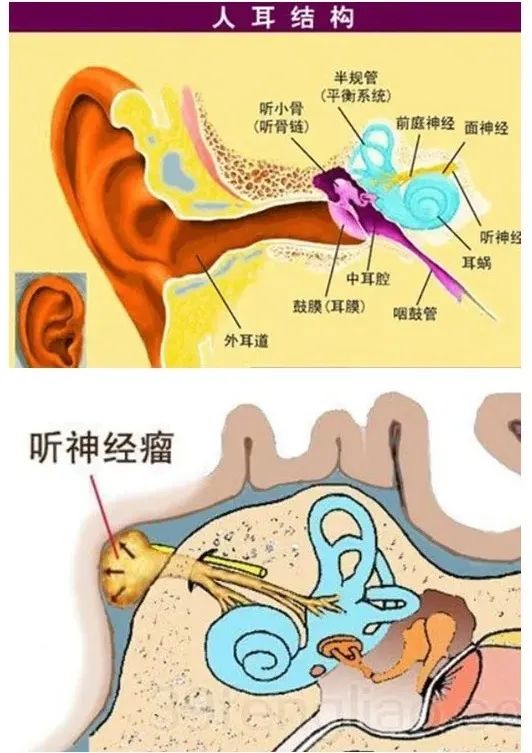 听神经位置图片图片