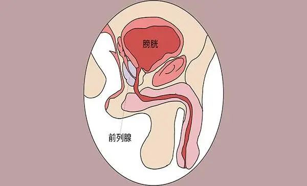 有前列腺增生別忽視別硬扛