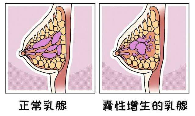 乳腺时钟分布图图片