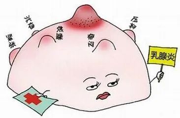 乳腺结节超声没看到肿物,却看到了钙化,血流丰富区,腋窝和/或锁骨上
