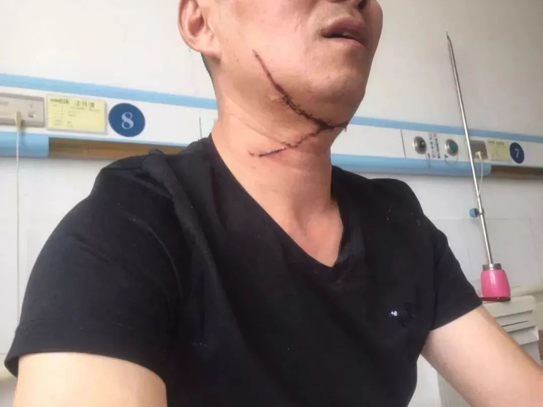 放风筝被割喉春天这件事要警惕