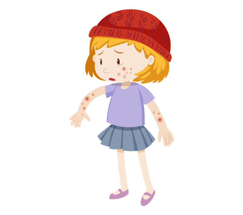 湿疹并不是湿出来的关于湿疹这些你要了解