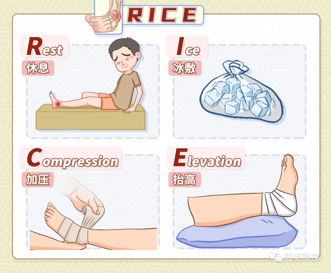 简单来说,应急处理应遵循rice原则,rice在英文中是大米的意思,为了