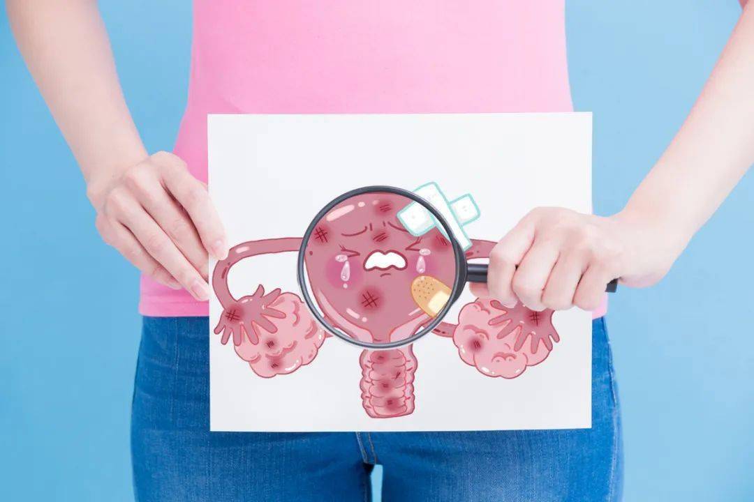 子宫内膜癌腹痛位置图图片