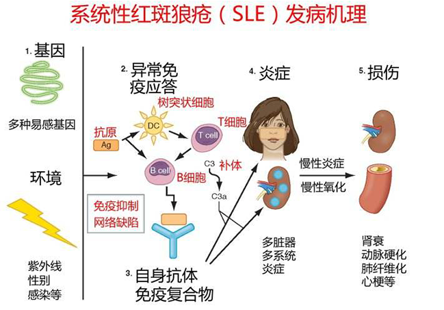 义诊不必谈狼色变专家带您认识系统性红斑狼疮风湿