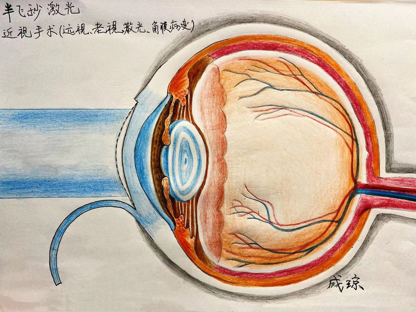 眼球内部结构就像芯片一样复杂而精密,虽然大家都知道眼睛很珍贵