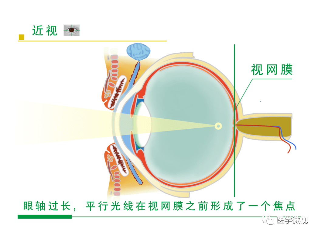 视网膜成像参数示意图图片