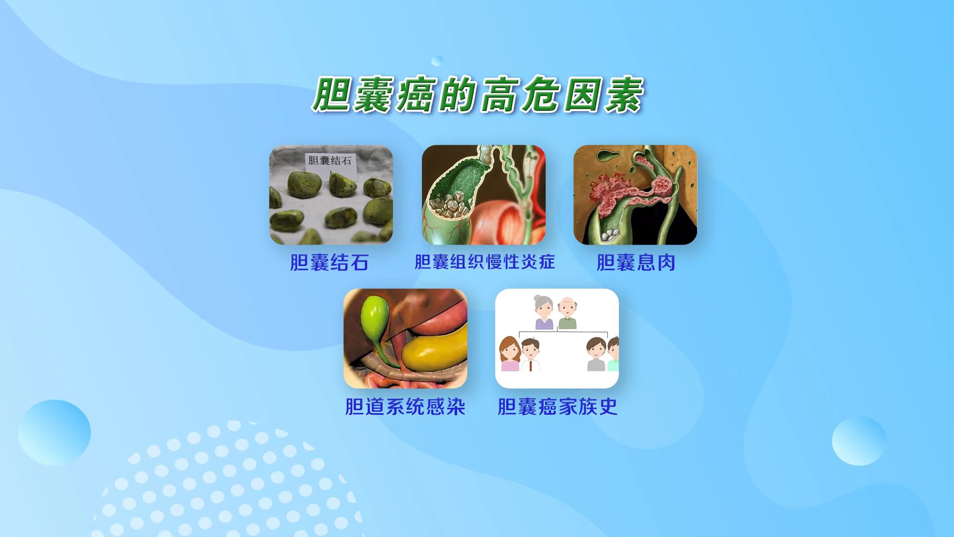 75%~90%胆囊癌患者合并有胆囊结石,胆囊结石可能为胆囊癌最大的诱发