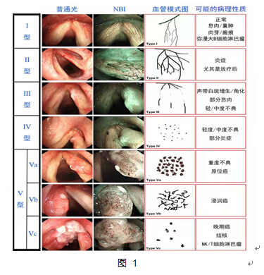 喉癌喉镜报告单图片图片