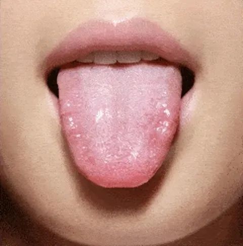3:舌苔的状态大便正常,一两张手纸就可擦干净,但体内有湿的人,要4~5张