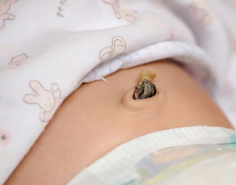 不仅如此,肚脐不同形状也能反映你的健康状况.