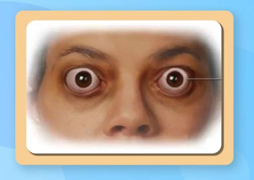 惊看眼科竟查出糖尿病一眼识透全身疾病出现这些症状赶紧自查