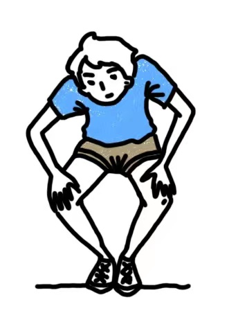 臀肌挛缩症是臀肌,髂胫束及相关筋膜发生变性与挛缩的临床综合征.