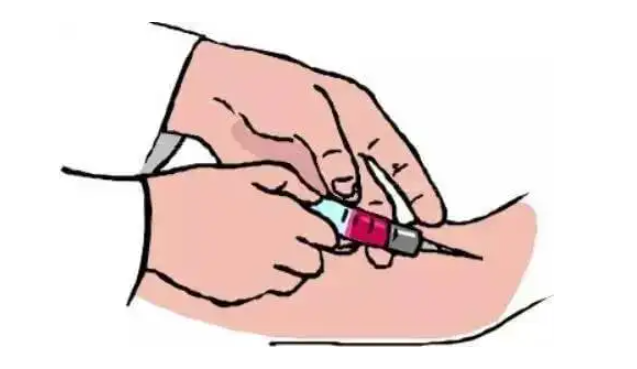抽血后淤青鼓包该谁背锅