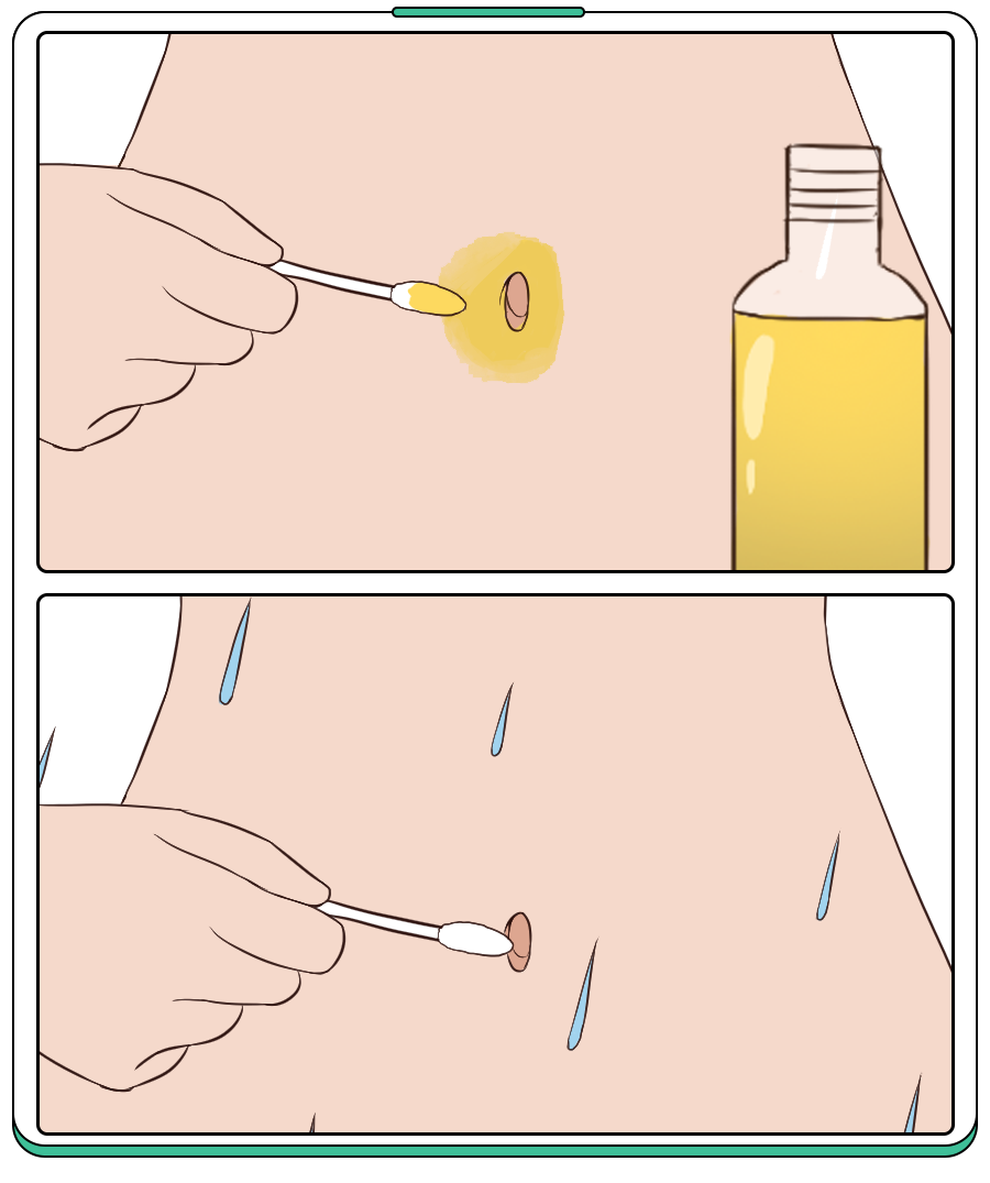 肚脐竟比马桶还脏夏季清洁宝宝肚脐这个方法干净又安全
