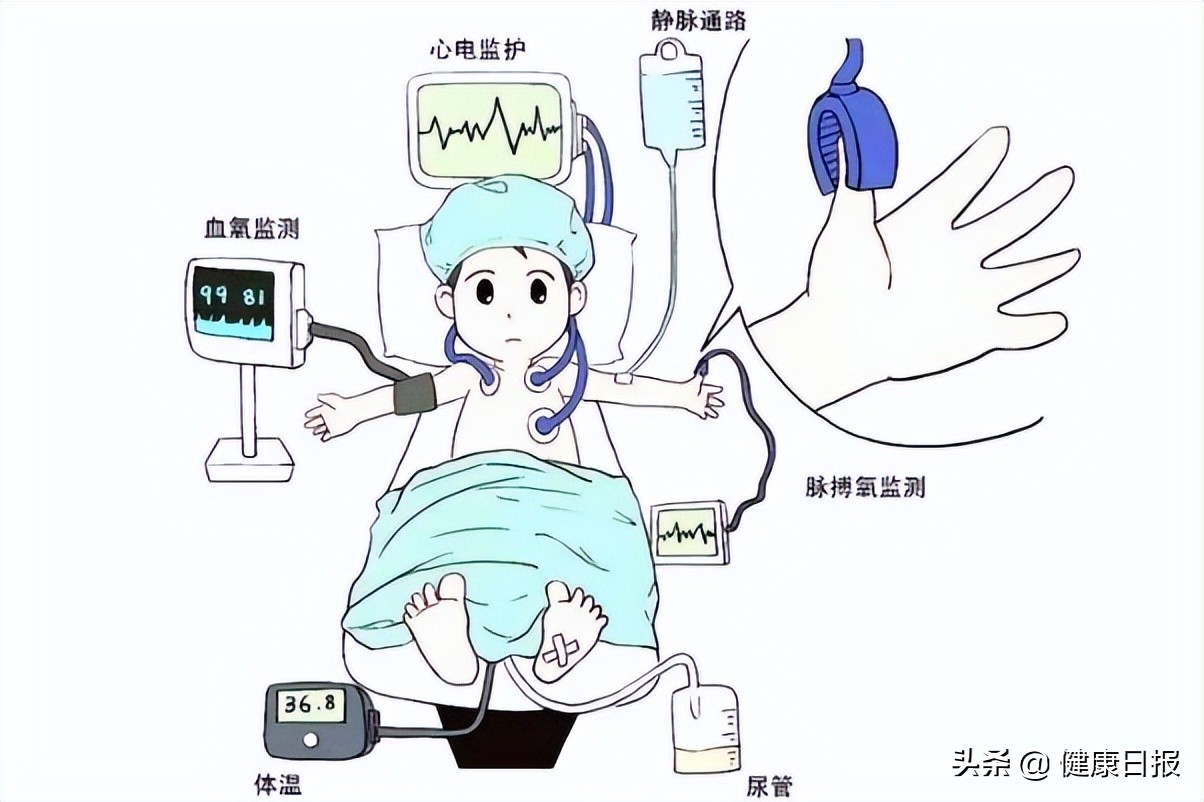 开刀去病麻醉保命你可知道手术中全麻有哪些危害